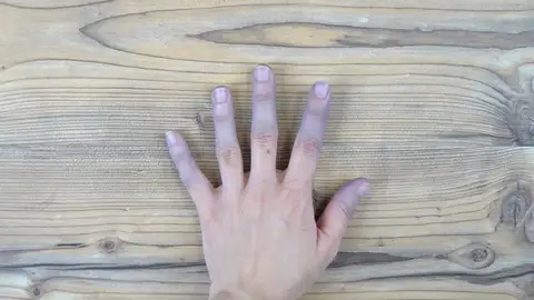 Dedos azulados Dedos azulados