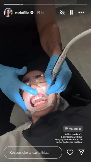 Carla Flila hablando sobre la retirada de sus carillas dentales Carla Flila hablando sobre la retirada de sus carillas dentales