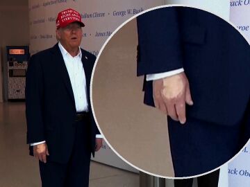 Mano maquillada de Trump