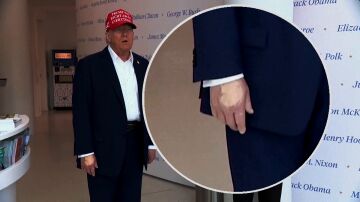 Mano maquillada de Trump