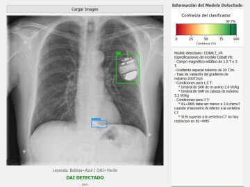 Radiografía de pulmones