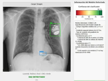 Radiografía de pulmones Radiografía de pulmones