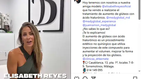 Elisabeth Reyes en la clínica del doctor Bernete, antes de someterse al aumento de glúteo Elisabeth Reyes en la clínica del doctor Bernete, antes de someterse al aumento de glúteo