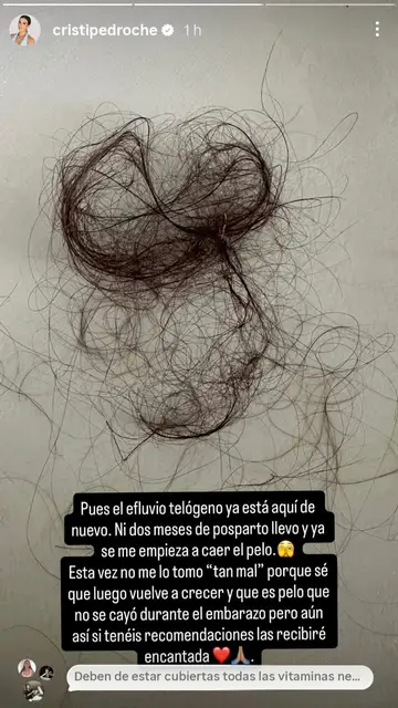 Historia de Cristina Pedroche sobre su caída de cabello en el posparto Historia de Cristina Pedroche sobre su caída de cabello en el posparto