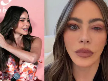 Sofía Vergara y su reacción alérgica Sofía Vergara y su reacción alérgica