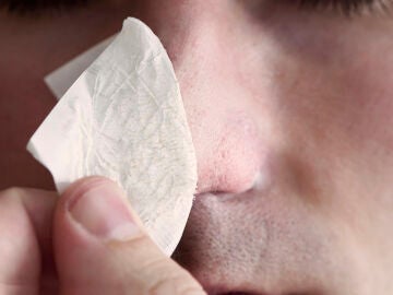 Puntos negros en la nariz