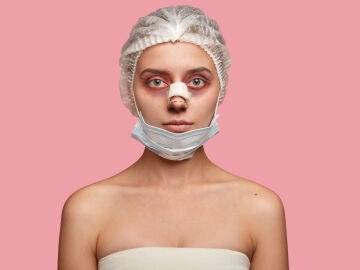 Una mujer tras operarse del rostro