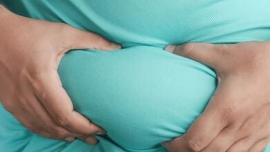Galicia busca 12.000 voluntarios para un plan pionero de lucha contra la obesidad que padece el 16% de los gallegos