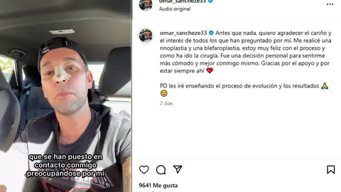 Vídeo de Omar Sánchez explicando las operaciones Vídeo de Omar Sánchez explicando las operaciones
