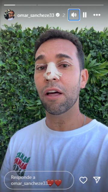 Omar Sánchez operado de la nariz y los párpados