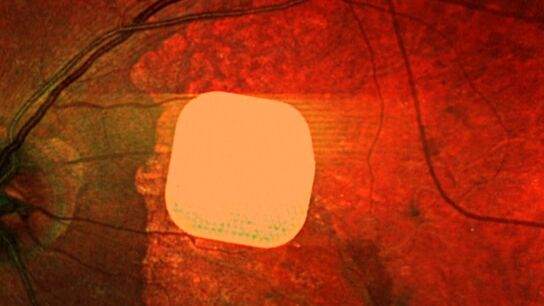 Microchip vista