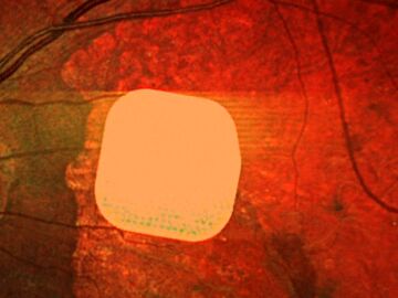 Microchip vista Microchip vista