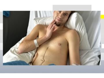 "Pensamos que era una gastroenteritis": el joven australiano que necesita un segundo trasplante de hígado