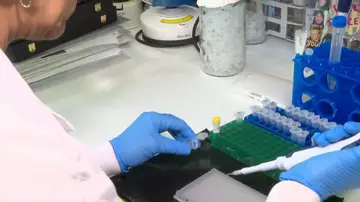 Identifican la célula de origen del Sarcoma de Ewing Identifican la célula de origen del Sarcoma de Ewing