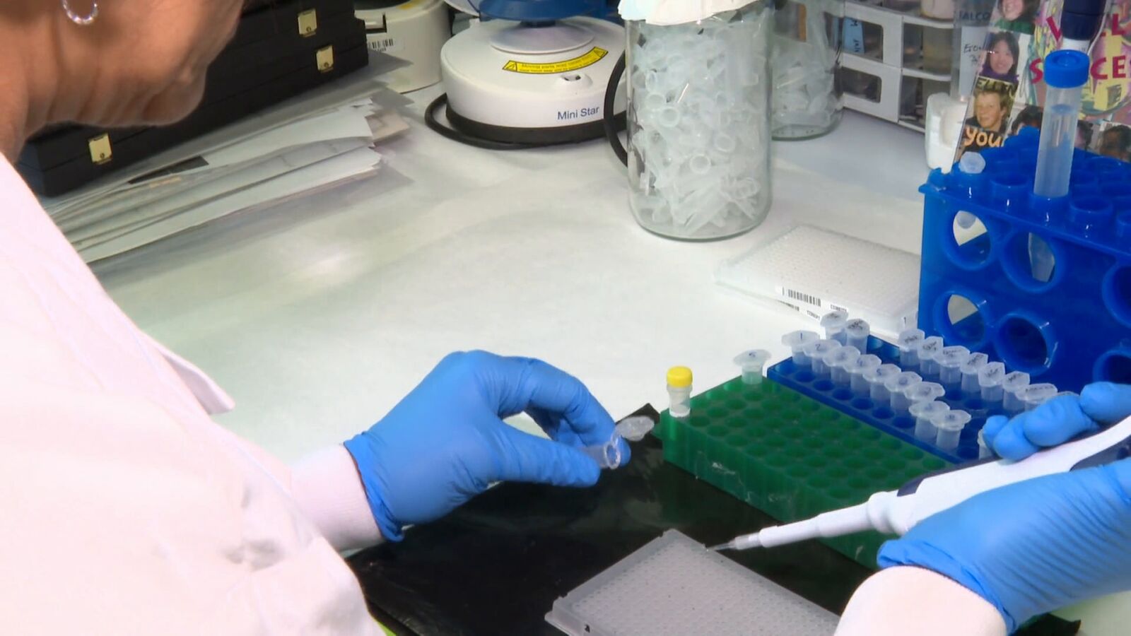 Identifican la célula de origen del Sarcoma de Ewing, un tipo de cáncer infantil muy agresivo
