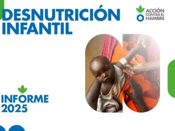 Informe desnutrición infantil Acción contra el Hambre