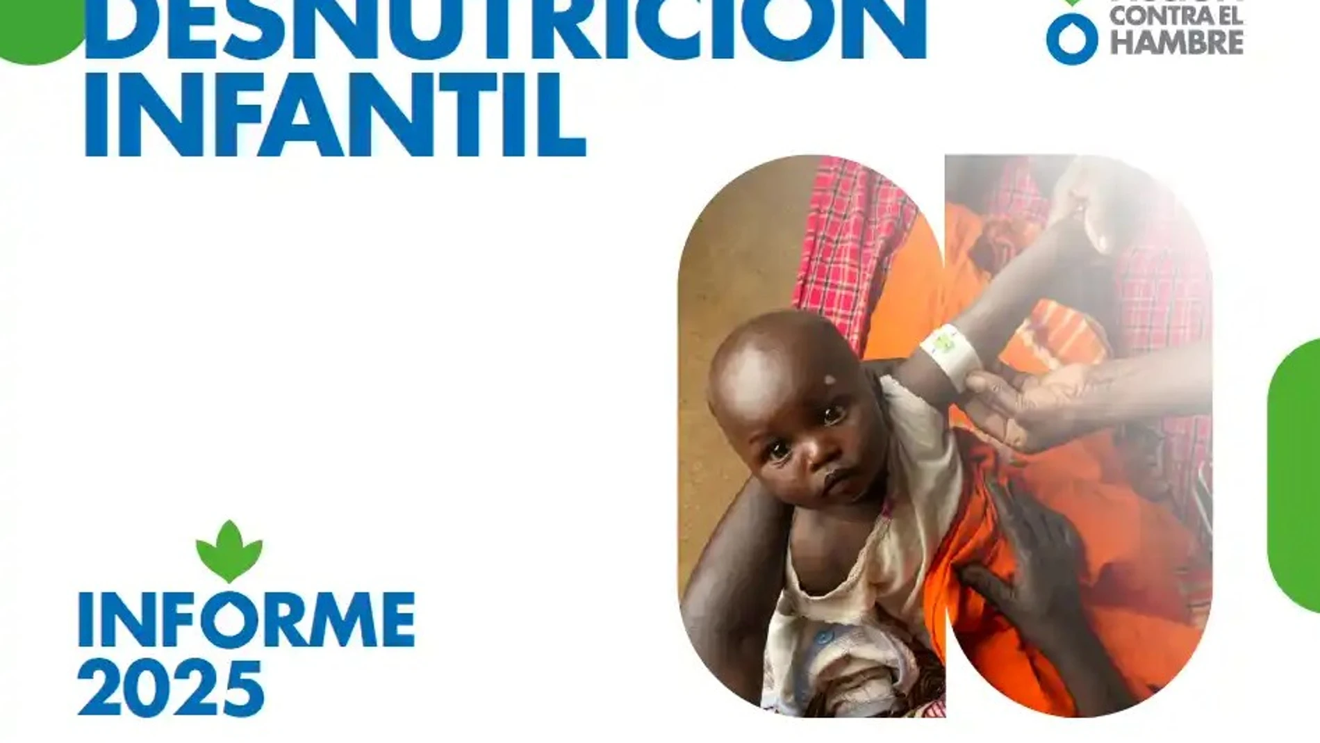 Informe desnutrición infantil Acción contra el Hambre Informe desnutrición infantil Acción contra el Hambre