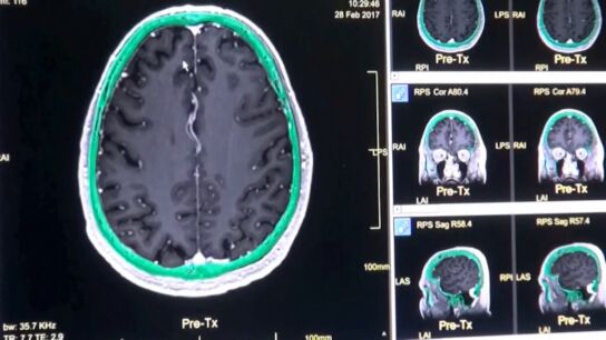 Pruebas de la investigaci&oacute;n de las cinco etapas de un cerebro humano a lo largo de su vida