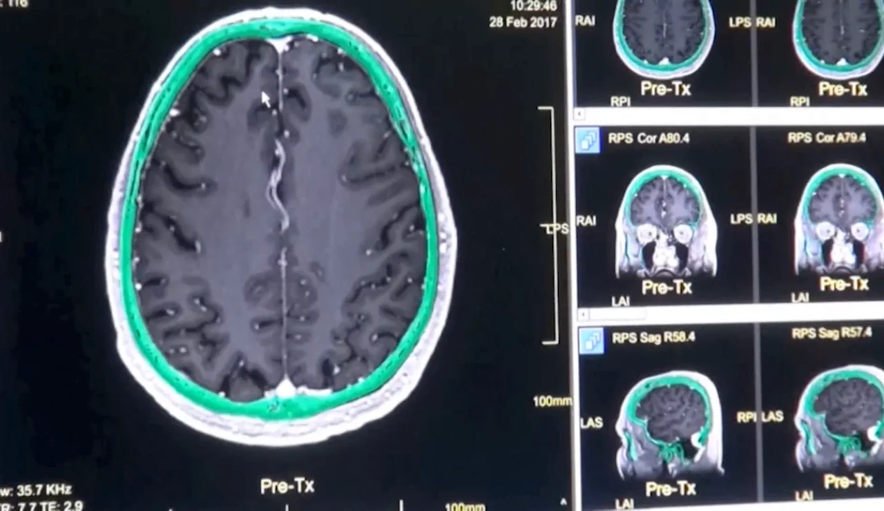 Pruebas de la investigación de las cinco etapas de un cerebro humano a lo largo de su vida