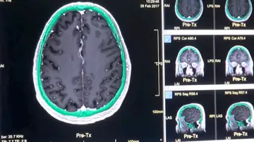 Pruebas de la investigación de las cinco etapas de un cerebro humano a lo largo de su vida Pruebas de la investigación de las cinco etapas de un cerebro humano a lo largo de su vida