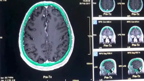 Pruebas de la investigación de las cinco etapas de un cerebro humano a lo largo de su vida Pruebas de la investigación de las cinco etapas de un cerebro humano a lo largo de su vida