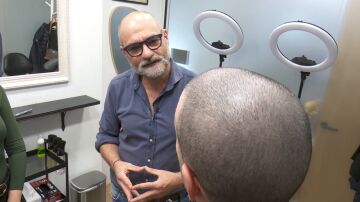 Tratamientos contra la calvicie