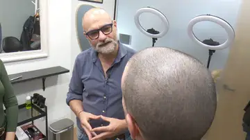 Tratamientos contra la calvicie Tratamientos contra la calvicie