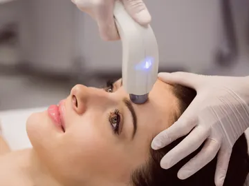 Láser facial Láser facial