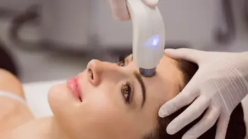 Láser facial Láser facial