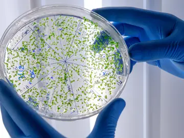 Bacterias multirresistentes Bacterias multirresistentes