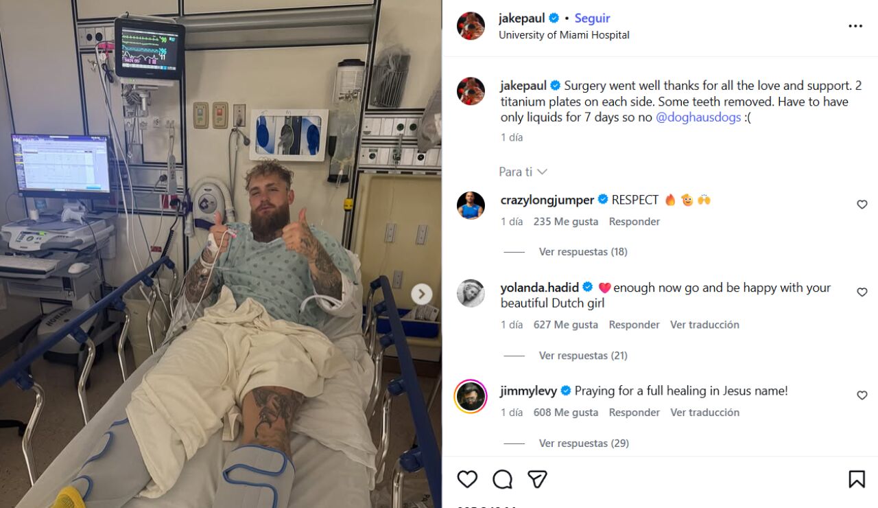 Jake Paul y su operaci&oacute;n de mand&iacute;bula.