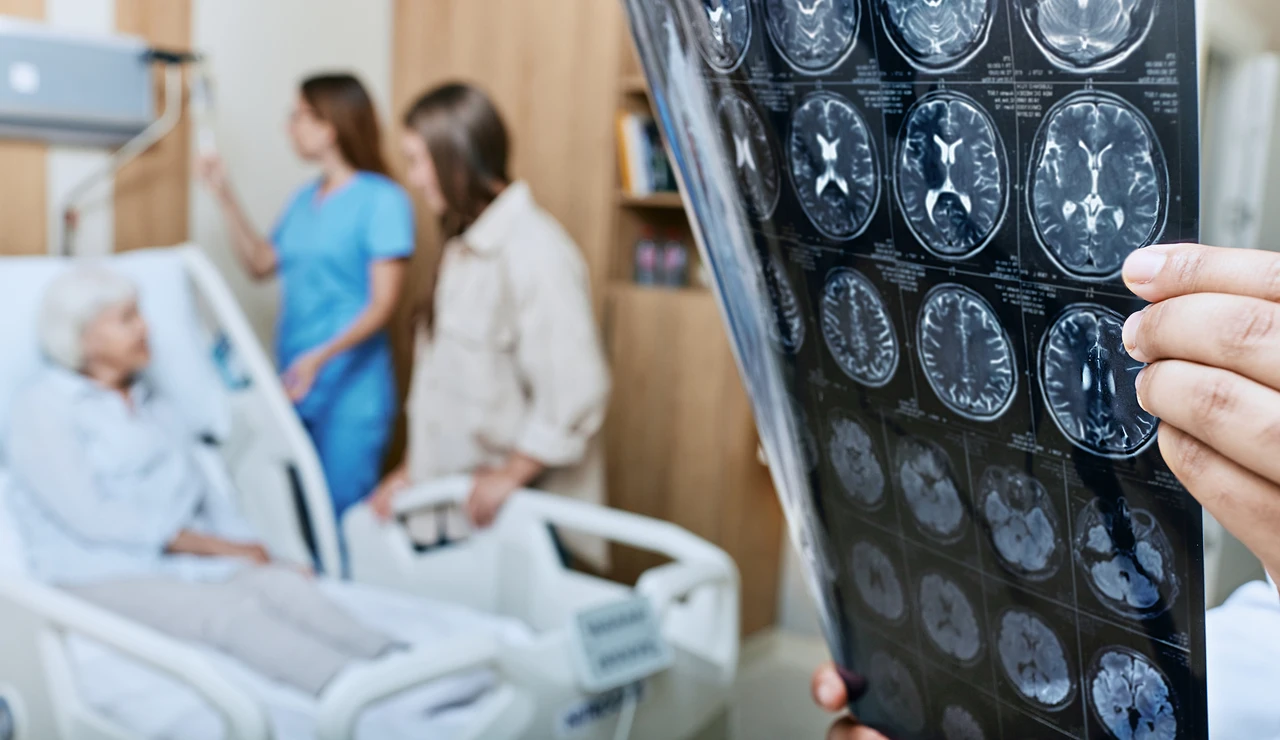 Tratamiento Alzheimer