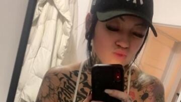 Jessica Chagnon, fallecida en Turqu&iacute;a tras una abdominoplastia
