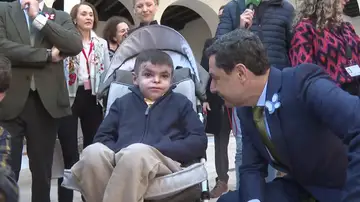 Leo, el niño con piel de mariposa, junto al presidente de la Junta de Andalucía, Juanma Moreno Leo, el niño con piel de mariposa, junto al presidente de la Junta de Andalucía, Juanma Moreno