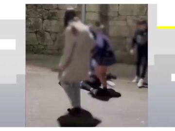 DURAS IM&Aacute;GENES | Brutal agresi&oacute;n a una menor en Pontevedra: "Le arrancaron mechones y los exhib&iacute;a como un trofeo"