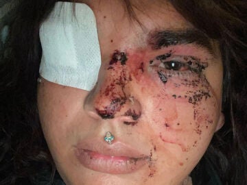 Miss Trans Zamora recibe una paliza en La Ba&ntilde;eza, Le&oacute;n.