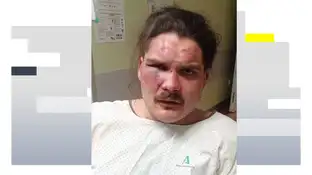 Joven agredido en La Herradura (Málaga) Joven agredido en La Herradura (Málaga)