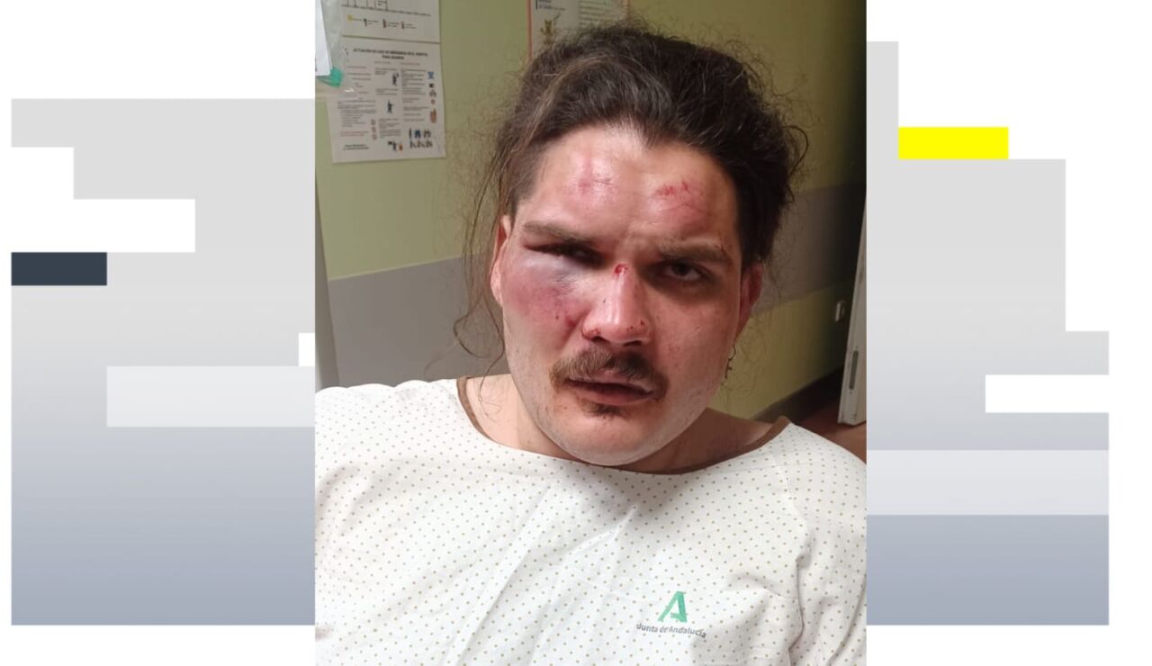 Joven agredido en La Herradura (M&aacute;laga)