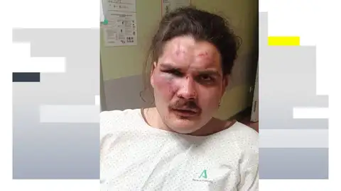 Joven agredido en La Herradura (Málaga) Joven agredido en La Herradura (Málaga)