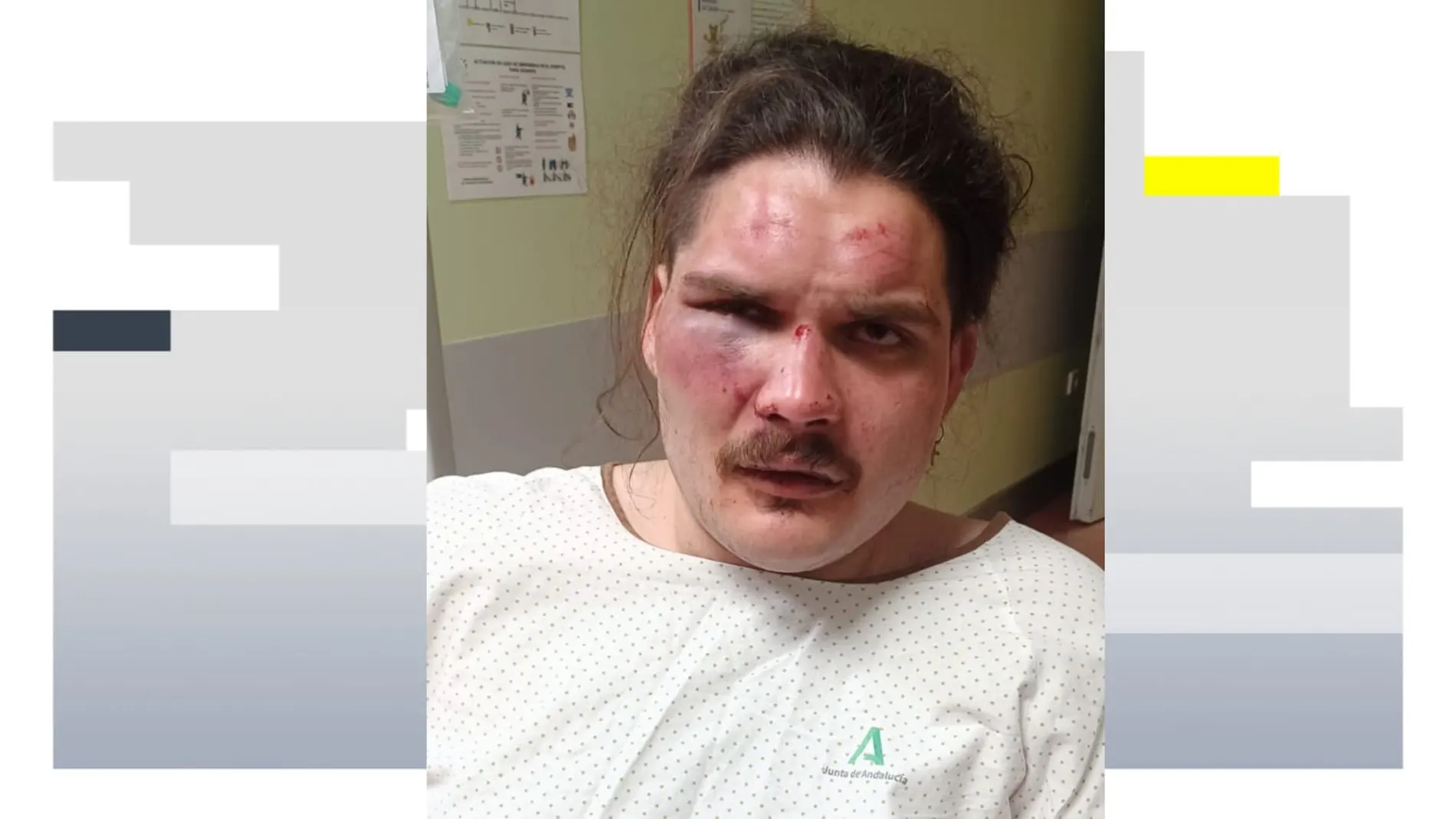 Joven agredido en La Herradura (Málaga) Joven agredido en La Herradura (Málaga)