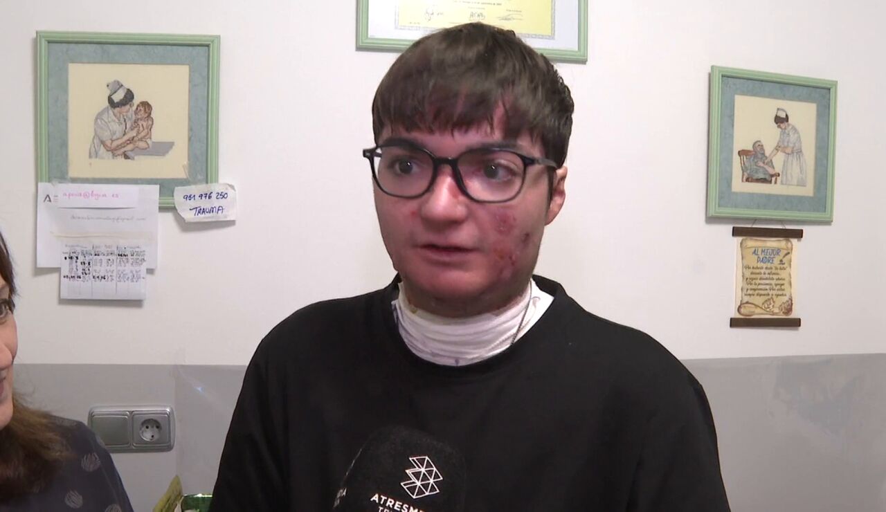 Adri&aacute;n, paciente que recibir&aacute; tratamiento para la piel de mariposa