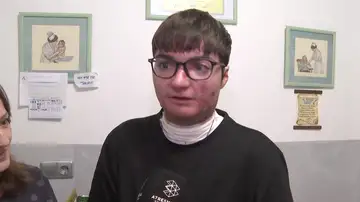 Adrián, paciente que recibirá tratamiento para la piel de mariposa Adrián, paciente que recibirá tratamiento para la piel de mariposa