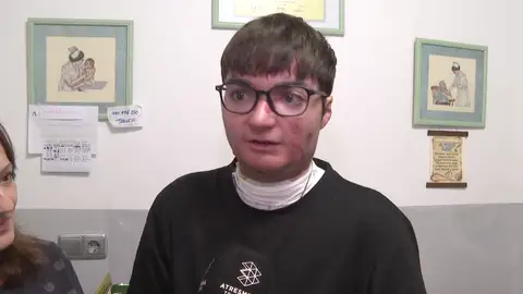 Adrián, paciente que recibirá tratamiento para la piel de mariposa Adrián, paciente que recibirá tratamiento para la piel de mariposa