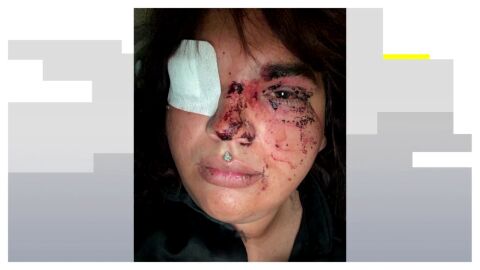 Detenidas cinco mujeres por la brutal agresi&oacute;n grupal a Miss Trans Zamora en un pub de La Ba&ntilde;eza, Le&oacute;n 