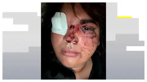 Detenidas cinco mujeres por la brutal agresión grupal a Miss Trans Zamora en un pub de La Bañeza, León Detenidas cinco mujeres por la brutal agresión grupal a Miss Trans Zamora en un pub de La Bañeza, León