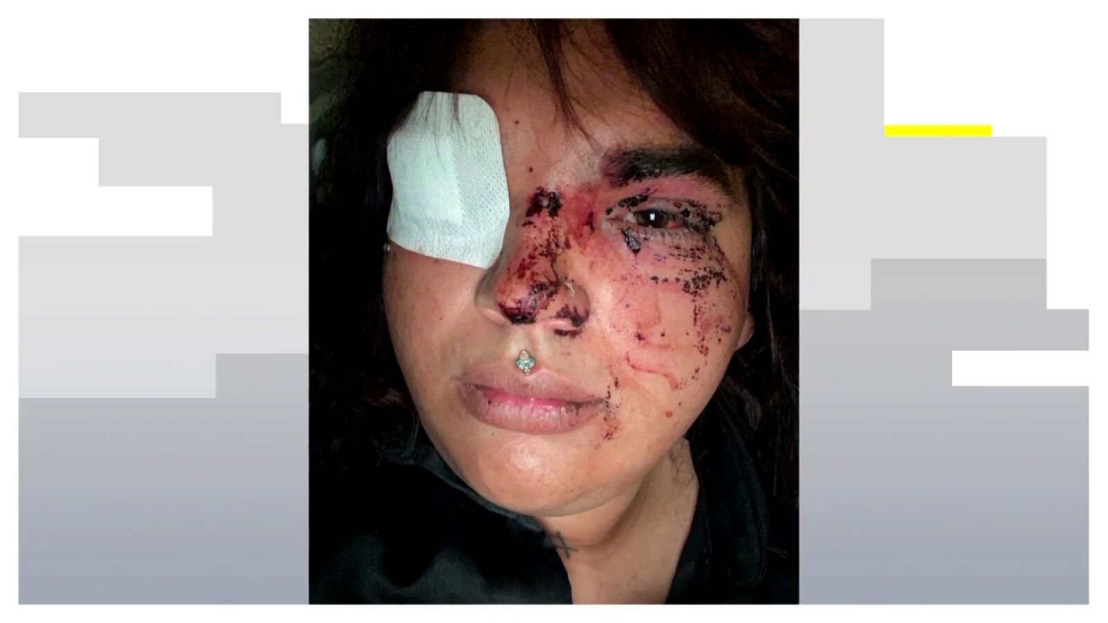 Detenidas cinco mujeres por la brutal agresión grupal a Miss Trans Zamora en un pub de La Bañeza, León 