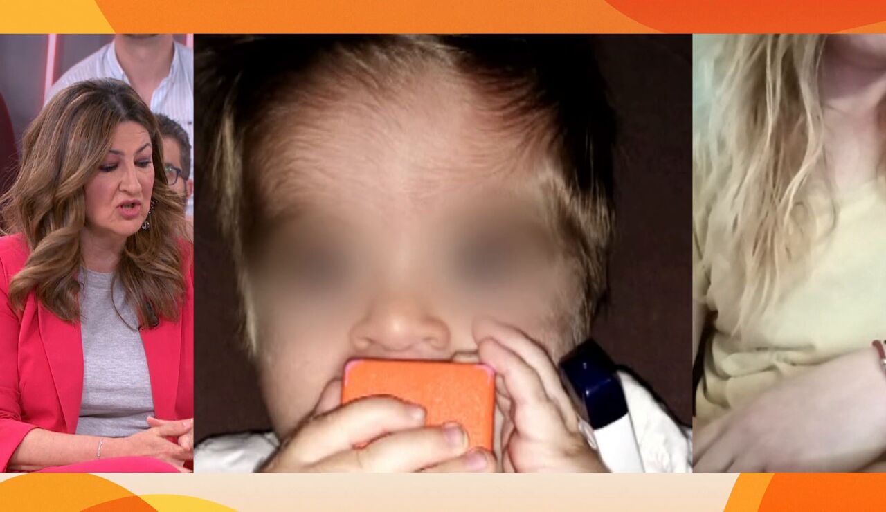 S&iacute;ndrome de hombre lobo