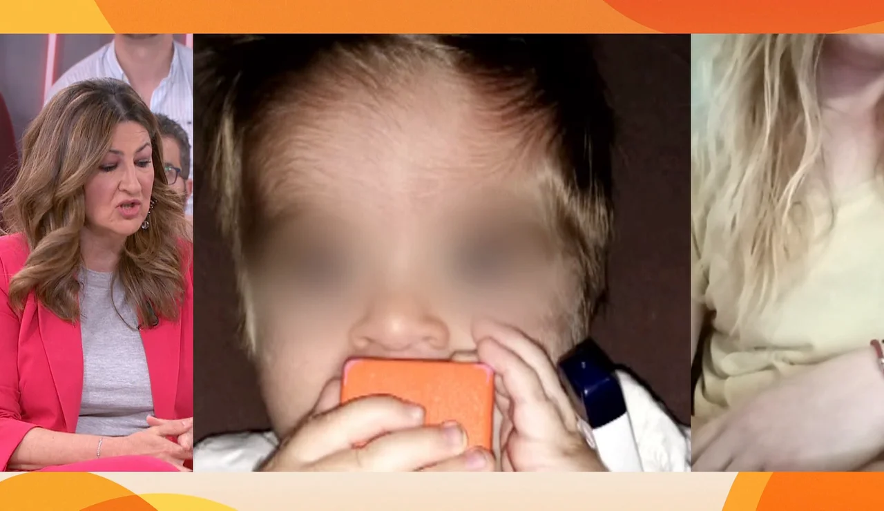 Síndrome de hombre lobo