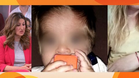 S&iacute;ndrome de hombre lobo