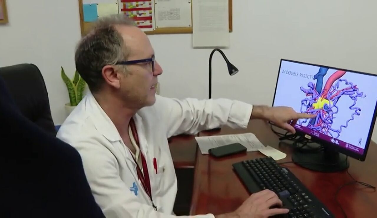 Extirpan un tipo de c&aacute;ncer de p&aacute;ncreas considerado inoperable